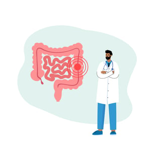 Colorectal Cancer Diagram-01-01