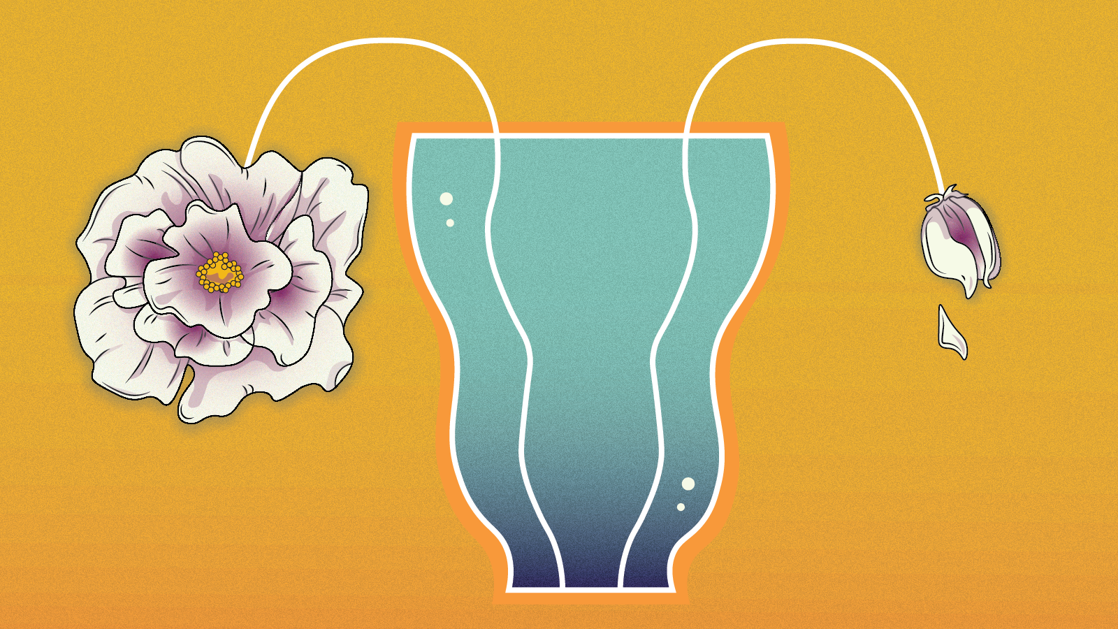 Ovarian Cancer Prevention: What You Can Do